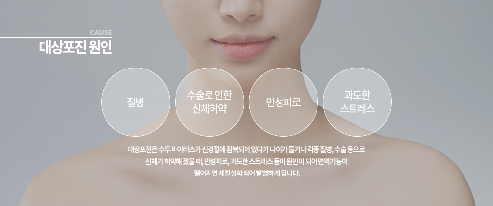 대상포진 원인
대상포진은 수두 바이러스가 신경절에 잠복되어 있다가 나이가 들거나 각종 질병, 수술 등으로 신체가 허약해 졌을 때, 만성피로, 과도한 스트레스 등이 원인이 되어 면역기능이 떨어지면 재활성화 되어 발병하게 됩니다.
