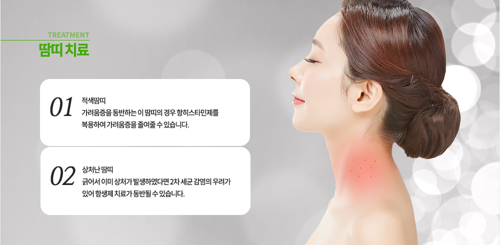 땀띠 치료
적색땀띠 : 가려움증을 동반하는 이 땀띠의 경우 항히스타민제를 복용하여 가려움증을 줄여줄 수 있습니다.
상처난 땀띠 : 긁어서 이미 상처가 발생하였다면 2차 세균 감염의 우료가 있어 항생제 치료가 동반될 수 있습니다.
