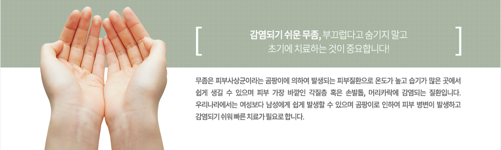 특징
무좀은 피부사상균이라는 곰팡이에 의하여 발생되는 피부질환으로 온도가 높고 습기가 많은 곳에서 쉽게 생길 수 있으며 피부 가장 바깥인 각질층 혹은 손발톱, 머리카락에 감염되는 질환입니다. 우리나라에서는 여성보다 남성에게 쉽게 발생할 수 있으며 곰팡이로 인하여 피부 병변이 발생하고 감염되기 쉬어 빠른 치료가 필요로 합니다.
