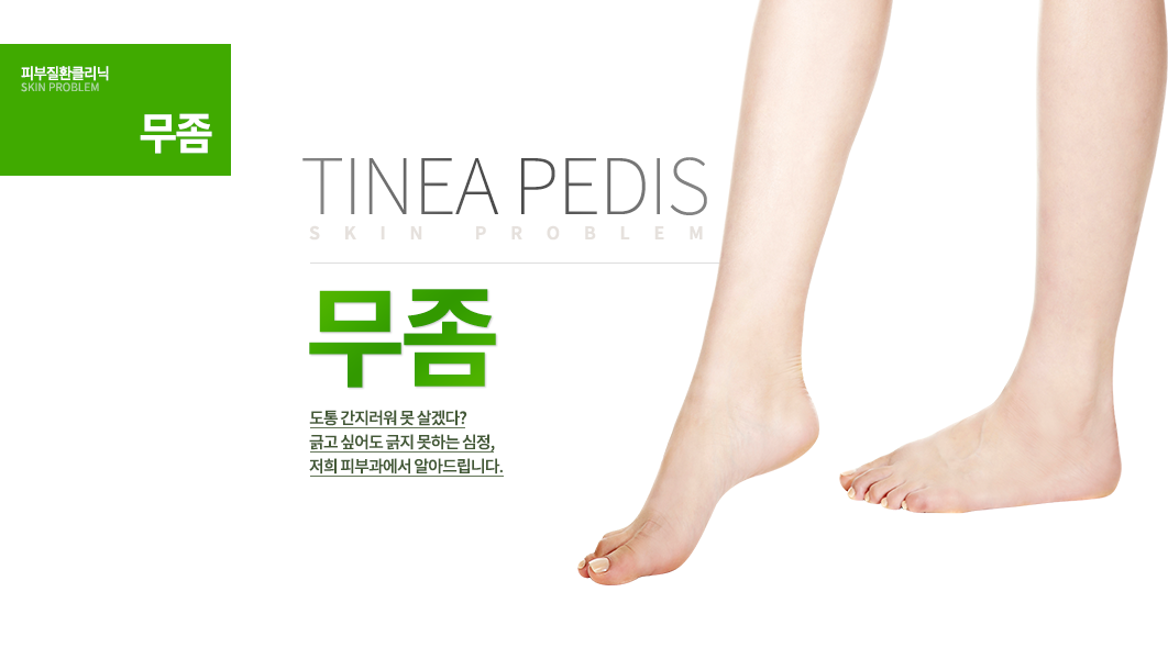 무좀
도통 간지러워 못 살겠다?
긁고 싶어도 긁지 못하는 심정, 저희 피부과에서 알아드립니다.

