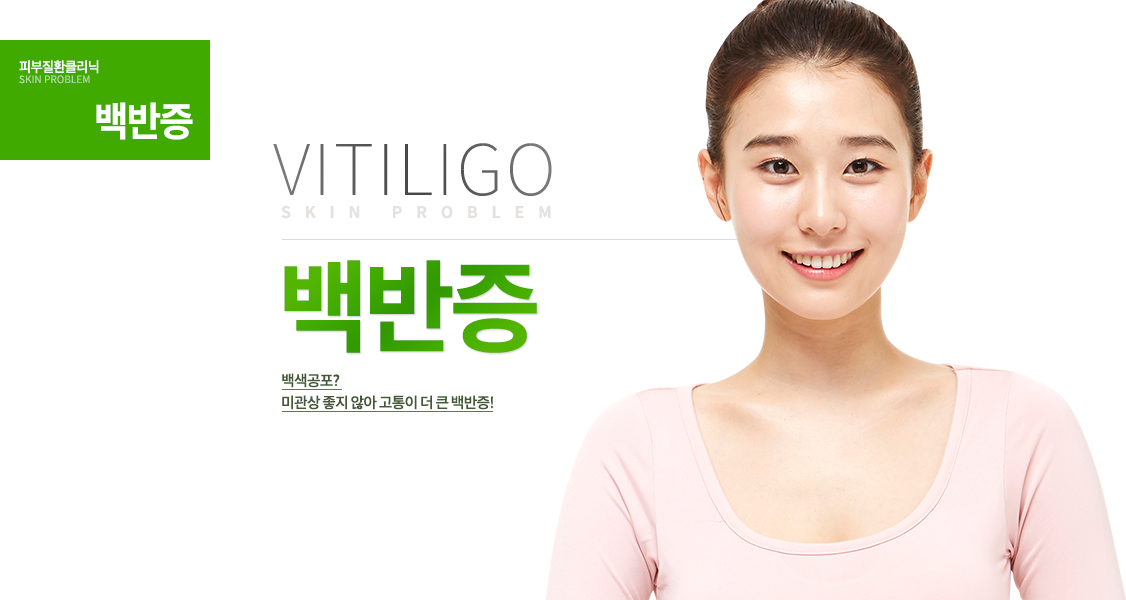 백반증
백색공포?
미관상 좋지 않아 고통이 더 큰 백반증!
