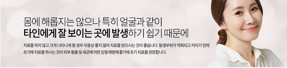 
몸에 해롭지는 않으나 특히 얼굴과 같이 타인에게 잘 보이는 곳에 발생하기 쉽기 때문에 치료를 하지 않고 크게 나타나게 될 경우 미용상 좋지 않아 치료를 받으시는 것이 좋습니다. 발생부위가 악화되고 커지기 전에 초기에 치료를 하시는 것이 외부 돌출 및 세균에 의한 감염 예방에 좋기에 초기 치료를 권장합니다
