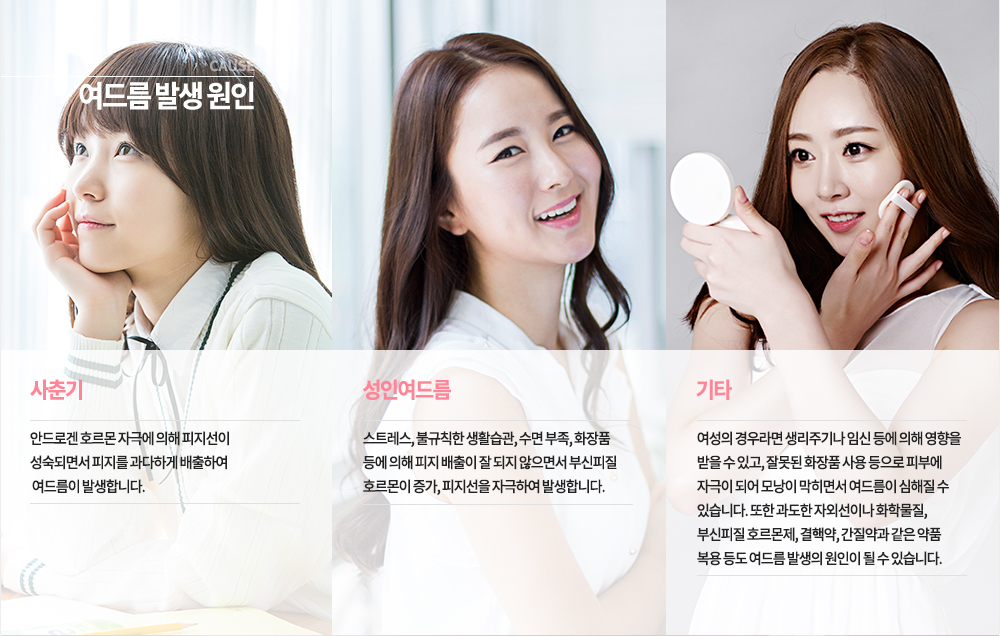 여드름 발생 원인 (연령별)
-사춘기 : 안드로겐 호르몬 자극에 의해 피지선이 성숙되면서 피지를 과다하게 배출하여 여드름이 발생합니다.
-성인여드름 : 스트레스, 불규칙한 생활습관, 수면 부족, 화장품 등에 의해 피지 배출이 잘 되지 않으면서 부신피질 호르몬이 증가, 피지선을 자극하여 발생합니다.
-기타 : 여성의 경우라면 생리주기나 임신 등에 의해 영향을 받을 수 있고, 잘못된 화장품 사용 등으로 피부에 자극이 되어 모낭이 막히면서 여드름이 심해질 수 있습니다. 또한 과도한 자외선이나 화학물질, 부신피질 호르몬제, 결핵약, 간질약과 같은 약품 복용 등도 여드름 발생의 원인이 될 수 있습니다.

