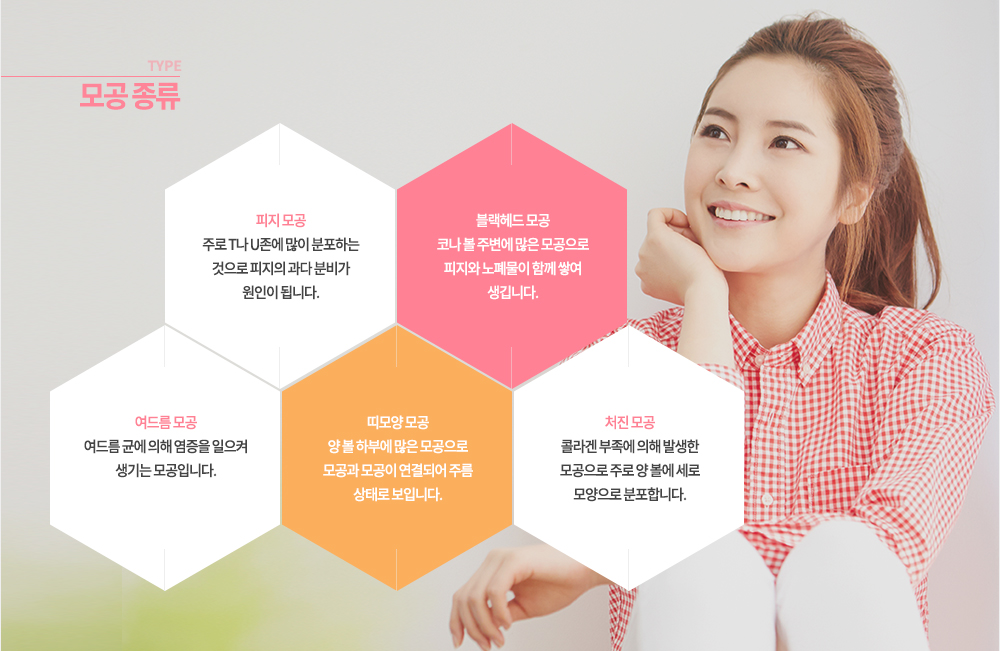 -모공 종류
1. 피지 모공 : 주로 T나 U존에 많이 분포하는 것으로 피지의 과다 분비가 원인이 됩니다.
2. 블랙헤드 모공 : 코나 볼 주변에 많은 모공으로 피지와 노폐물이 함께 쌓여 생깁니다.
3. 여드름 모공 : 여드름 균에 의해 염증을 일으켜 생기는 모공입니다.
4. 띠모양 모공 : 양 볼 하부에 많은 모공으로 모공과 모공이 연결되어 주름 상태로 보입니다.
5. 처진 모공 : 콜라겐 부족에 의해 발생한 모공으로 주로 양 볼에 세로 모양으로 분포합니다.


