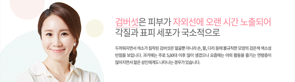 검버섯
피부가 자외선에 오랜 시간 노출되어 각질과 표피 세포가 국소적으로 두꺼워지면서 색소가 침착된 검버섯은 얼굴뿐 아니라 손, 팔, 다리 등에 불규칙한 모양의 검은색 색소성 반점을 보입니다.
과거에는 주로 5,60대 이후 많이 생겼으나 요즘에는 야외 활동을 즐기는 연령층이 많아지면서 젊은 성인에게도 나타나는 경우가 있습니다.
