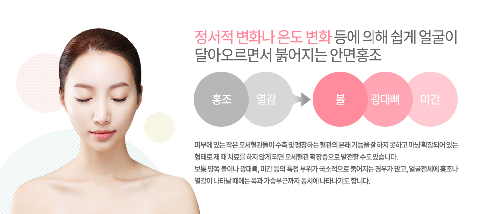 특징
정서적 변화나 온도 변화 등에 의해 쉽게 얼굴이 달아오르면서 붉어지는 안면홍조는 피부에 있는 작은 모세혈관들이 수축 및 팽창하는 혈관의 본래 기능을 잘 하지 못하고 마냥 확장되어 있는 형태로 제 때 치료를 하지 않게 되면 모세혈관 확장증으로 발전할 수도 있습니다.
보통 양쪽 볼이나 광대뼈, 미간 등의 특정 부위가 국소적으로 붉어지는 경우가 많고, 얼굴전체에 홍조나 열감이 나타날 때에는 목과 가슴부근까지 동시에 나타나기도 합니다. 
