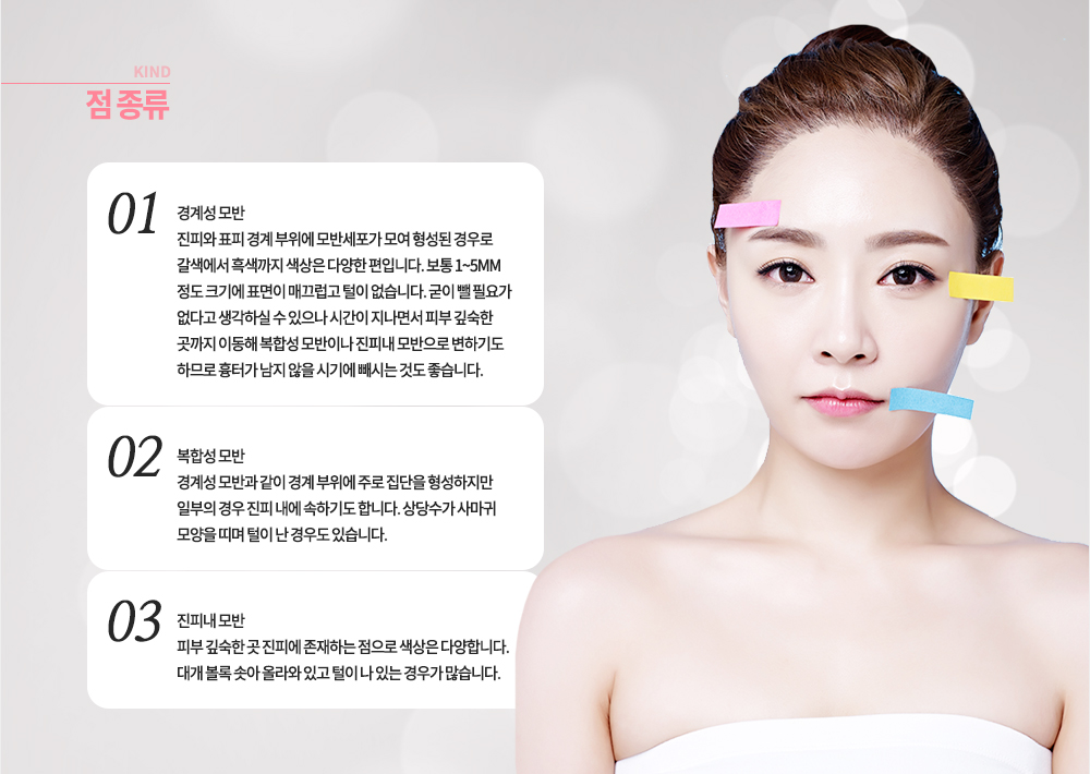 점 종류
1. 경계성 모반 : 진피와 표피 경계 부위에 모반세포가 모여 형성된 경우로 갈색에서 흑색까지 색상은 다양한 편입니다. 보통 1~5mm 정도 크기에 표면이 매끄럽고 털이 없습니다. 굳이 뺄 필요가 없다고 생각하실 수 있으나 시간이 지나면서 피부 깊숙한 곳까지 이동해 복합성 모반이나 진피내 모반으로 변하기도 하므로 흉터가 남지 않을 시기에 빼시는 것도 좋습니다.
2. 복합성 모반 : 경계성 모반과 같이 경계 부위에 주로 집단을 형성하지만 일부의 경우 진피 내에 속하기도 합니다. 상당수가 사마귀 모양을 띠며 털이 난 경우도 있습니다.
3. 진피내 모반 : 피부 깊숙한 곳 진피에 존재하는 점으로 색상은 다양합니다. 대개 볼록 솟아 올라와 있고 털이 나 있는 경우가 많습니다.
