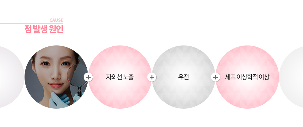 점 발생 원인
유전, 자외선 노출, 세포 이상학적 이상
-점, 언제 빼야 하나요?
점의 모양, 색깔 등이 변할 때
악성 흑색종과 구분이 어려울 때
물리적 자극이나 마찰 부위에 점이 있을 때
미용상 제거하길 원할 때
