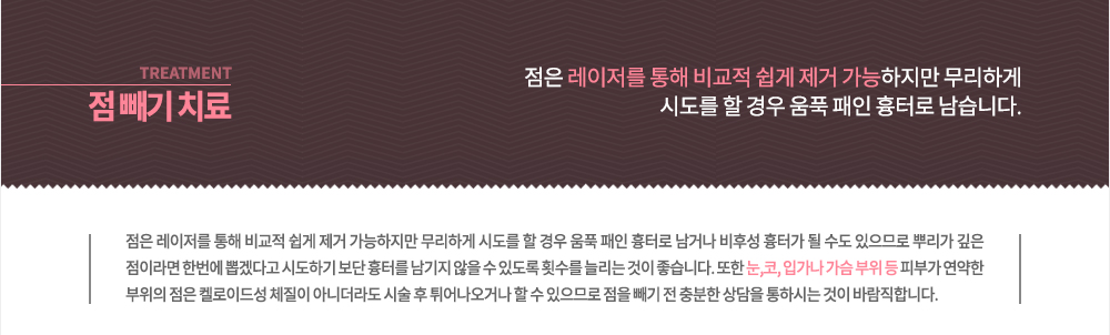 점 빼는 방법 레이저 치료 
점의 모양, 색깔 등이 변할 때
악성 흑색종과 구분이 어려울 때
물리적 자극이나 마찰 부위에 점이 있을 때
미용상 제거하길 원할 때
