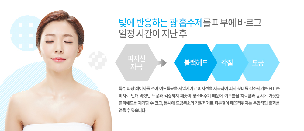 원리
빛에 반응하는 광 흡수제를 피부에 바르고 일정 시간이 지난 후 특수 파장 레이저를 쏘아 여드름균을 사멸시키고 피지선을 자극하여 피지 분비를 감소시키는 PDT는 피지로 인해 막혔던 모공과 각질까지 깨끗이 청소해주기 때문에 여드름을 치료함과 동시에 거뭇한 블랙헤드를 제거할 수 있고, 동시에 모공축소와 각질제거로 피부결이 매끄러워지는 복합적인 효과를 얻을 수 있습니다.
