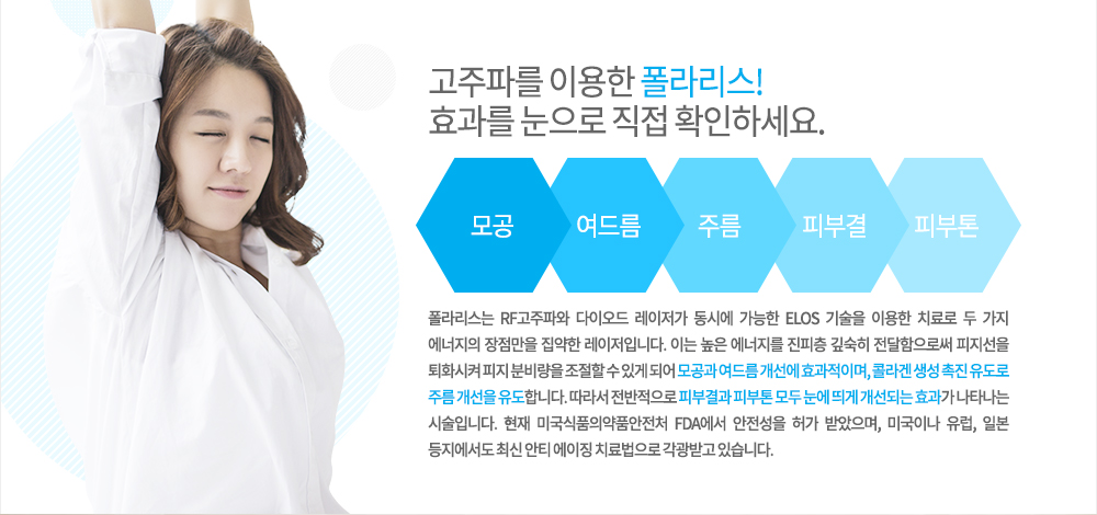 -특징
폴라리스는 RF고주파와 다이오드 레이저가 동시에 가능한 ELOS 기술을 이용한 치료로 두 가지 에너지의 장점만을 집약한 레이저입니다. 이는 높은 에너지를 진피층 깊숙히 전달함으로써 피지선을 퇴화시켜 피지 분비량을 조절할 수 있게 되어 모공과 여드름 개선에 효과적이며, 콜라겐 생성 촉진 유도로 주름 개선을 유도합니다. 따라서 전반적으로 피부결과 피부톤 모두 눈에 띄게 개선되는 효과가 나타나는 시술입니다. 현재 미국식품의약품안전처 FDA에서 안전성을 허가 받았으며, 미국이나 유럽, 일본 등지에서도 최신 안티 에이징 치료법으로 각광받고 있습니다.
